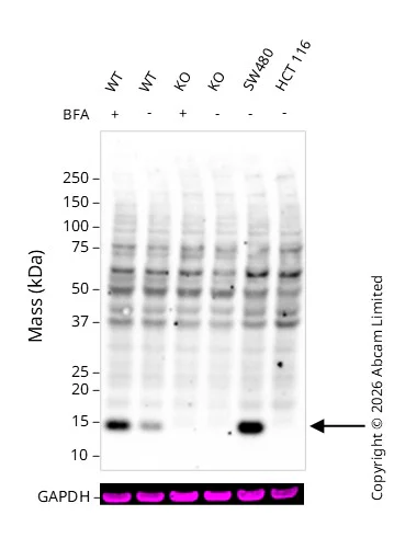 Western blot - Anti-Cystatin SN/CST1 antibody [EPR25933-111] - BSA and Azide free (AB307417)