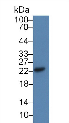Western blot - Anti-Cysteine Dioxygenase CDO1 antibody (AB232699)