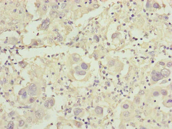 Immunohistochemistry (Formalin/PFA-fixed paraffin-embedded sections) - Anti-Cysteine Dioxygenase CDO1 antibody (AB234693)