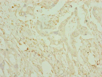 Immunohistochemistry (Formalin/PFA-fixed paraffin-embedded sections) - Anti-Cysteine Dioxygenase CDO1 antibody (AB234693)