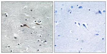 Immunohistochemistry (Formalin/PFA-fixed paraffin-embedded sections) - Anti-CYTL1 antibody (AB129767)