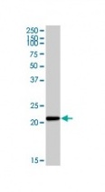 Western blot - Anti-Cytochrome b245 Light Chain/p22-phox antibody [44.1] (AB80896)