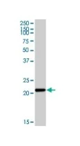 Western blot - Anti-Cytochrome b245 Light Chain/p22-phox antibody [44.1] (AB80896)