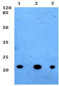Western blot - Anti-Cytochrome b245 Light Chain/p22-phox antibody (AB191512)