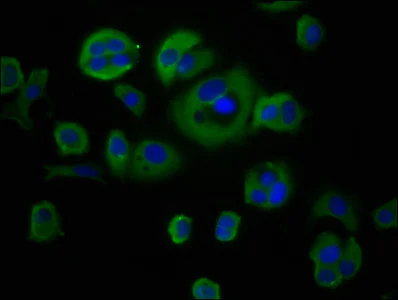 Immunocytochemistry/ Immunofluorescence - Anti-Cytochrome b245 Light Chain/p22-phox antibody (AB236295)