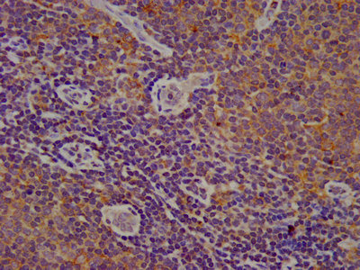 Immunohistochemistry (Formalin/PFA-fixed paraffin-embedded sections) - Anti-Cytochrome b245 Light Chain/p22-phox antibody (AB236295), expandable thumbnail