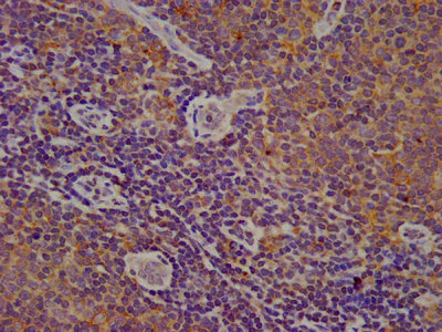 Immunohistochemistry (Formalin/PFA-fixed paraffin-embedded sections) - Anti-Cytochrome b245 Light Chain/p22-phox antibody (AB236295)