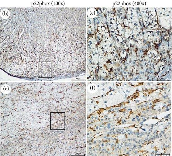 Immunohistochemistry (Formalin/PFA-fixed paraffin-embedded sections) - Anti-Cytochrome b245 Light Chain/p22-phox antibody (AB75941)