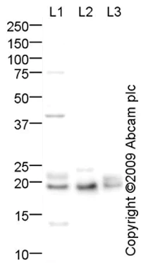 Western blot - Anti-Cytochrome b245 Light Chain/p22-phox antibody (AB75941)