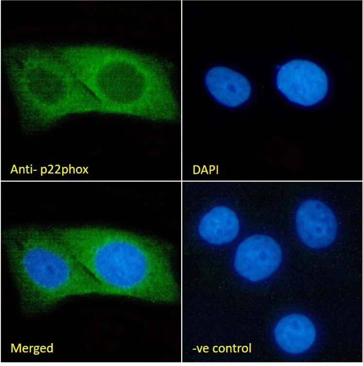 Immunocytochemistry/ Immunofluorescence - Anti-Cytochrome b245 Light Chain/p22-phox Antibody [CS9] (AB316356)