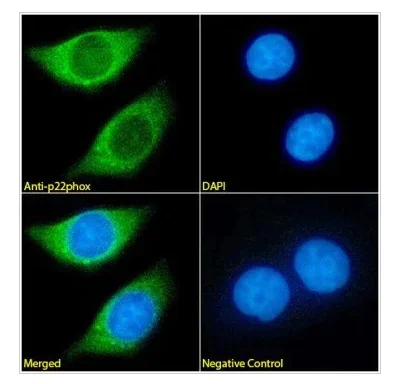Immunocytochemistry/ Immunofluorescence - Anti-Cytochrome b245 Light Chain/p22-phox Antibody [CS9] (AB316356)