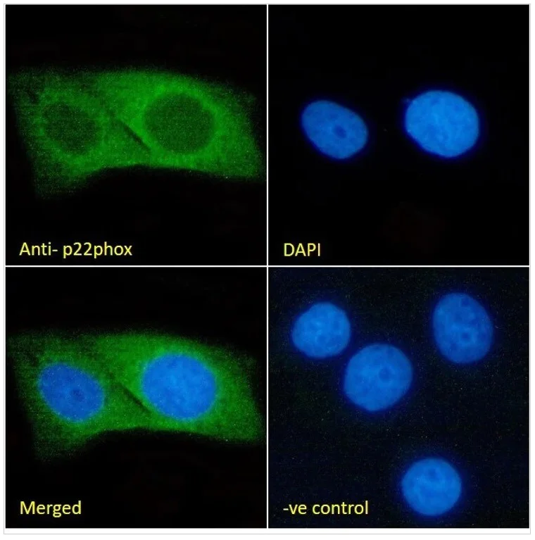 Immunocytochemistry/ Immunofluorescence - Anti-Cytochrome b245 Light Chain/p22-phox Antibody [CS9] (AB316356)