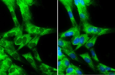 Immunocytochemistry/ Immunofluorescence - Anti-Cytochrome b5 antibody (AB228751)