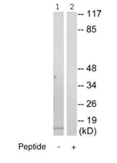 Western blot - Anti-Cytochrome b5 antibody (AB69801)