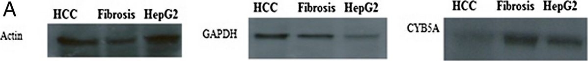 Western blot - Anti-Cytochrome b5 antibody (AB69801)