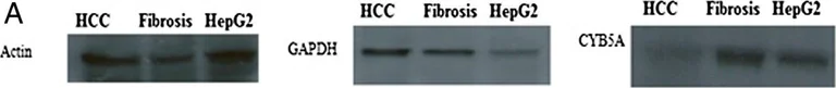 Western blot - Anti-Cytochrome b5 antibody (AB69801)