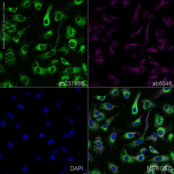 CPOX抗体[EPR11927(B)] (ab169766)| Abcam中文官网