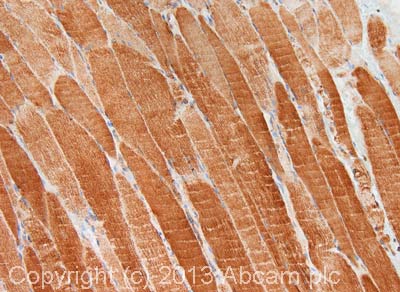 Immunohistochemistry (Formalin/PFA-fixed paraffin-embedded sections) - Anti-Cytochrome C antibody (AB90529), expandable thumbnail