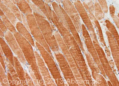 Immunohistochemistry (Formalin/PFA-fixed paraffin-embedded sections) - Anti-Cytochrome C antibody (AB90529)