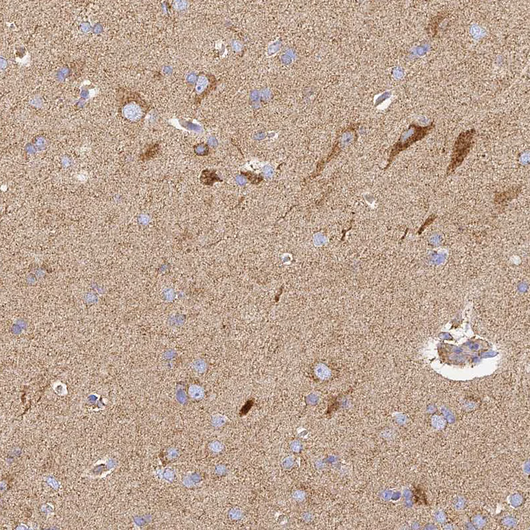 Immunohistochemistry (Formalin/PFA-fixed paraffin-embedded sections) - Anti-Cytochrome C Oxidase subunit VIc/COX6C antibody (AB204790)