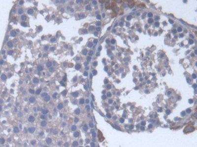 Immunohistochemistry (Formalin/PFA-fixed paraffin-embedded sections) - Anti-Cytochrome P450 17A1/CYP17A1 antibody (AB231914), expandable thumbnail