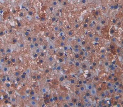 Immunohistochemistry (Formalin/PFA-fixed paraffin-embedded sections) - Anti-Cytochrome P450 17A1/CYP17A1 antibody (AB231914), expandable thumbnail