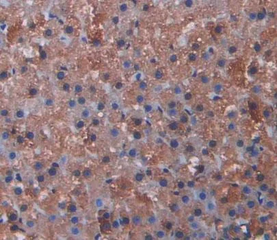 Immunohistochemistry (Formalin/PFA-fixed paraffin-embedded sections) - Anti-Cytochrome P450 17A1/CYP17A1 antibody (AB231914)