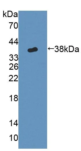 Western blot - Anti-Cytochrome P450 17A1/CYP17A1 antibody (AB231914)