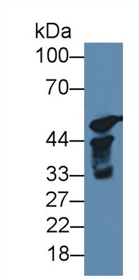 Western blot - Anti-Cytochrome P450 17A1/CYP17A1 antibody (AB231914), expandable thumbnail