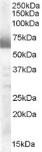 Western blot - Anti-Cytochrome P450 17A1/CYP17A1 antibody (AB48019)