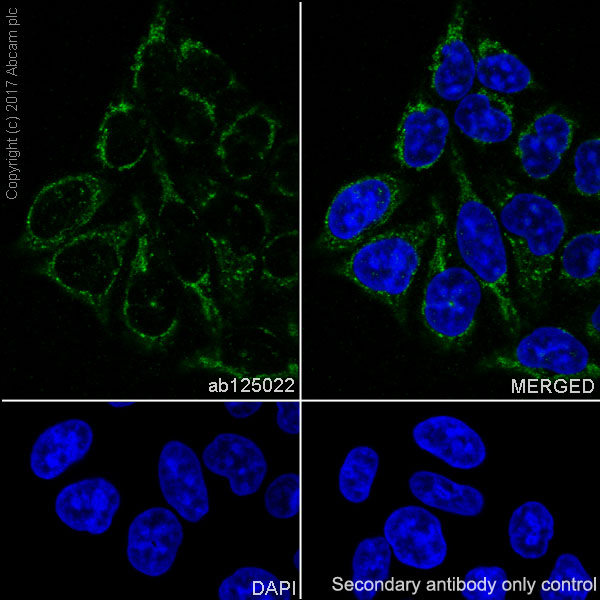 Immunocytochemistry/ Immunofluorescence - Anti-Cytochrome P450 17A1/CYP17A1 antibody [EPR6293] (AB125022), expandable thumbnail