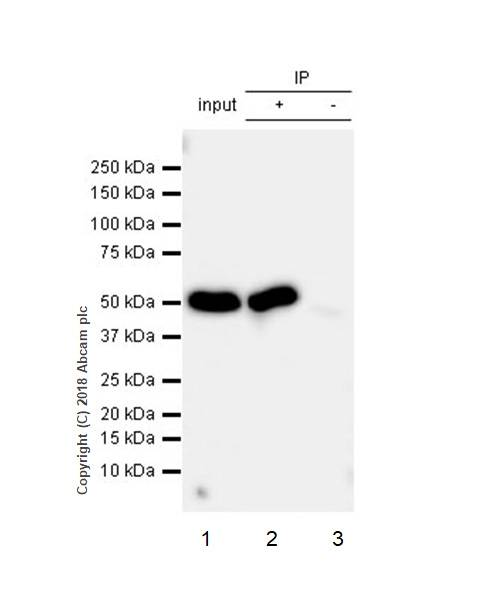 Immunoprecipitation - Anti-Cytochrome P450 17A1/CYP17A1 antibody [EPR6293] (AB125022), expandable thumbnail