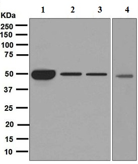 Western blot - Anti-Cytochrome P450 17A1/CYP17A1 antibody [EPR6293] (AB125022), expandable thumbnail