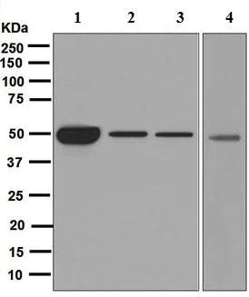Western blot - Anti-Cytochrome P450 17A1/CYP17A1 antibody [EPR6293] (AB125022)