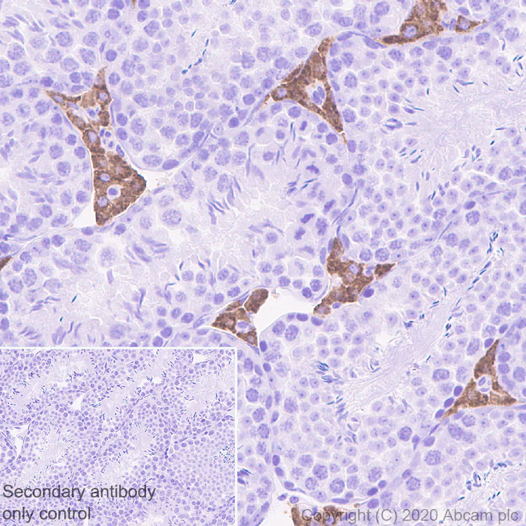 Immunohistochemistry (Formalin/PFA-fixed paraffin-embedded sections) - Anti-Cytochrome P450 17A1/CYP17A1 antibody [EPR6294(2)] (AB134910)