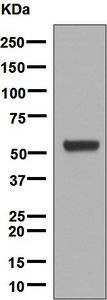 Western blot - Anti-Cytochrome P450 17A1/CYP17A1 antibody [EPR6294(2)] (AB134910)