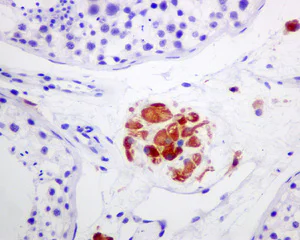 Immunohistochemistry (Formalin/PFA-fixed paraffin-embedded sections) - Anti-Cytochrome P450 17A1/CYP17A1 antibody [EPR6294(2)] - BSA and Azide free (AB248723)