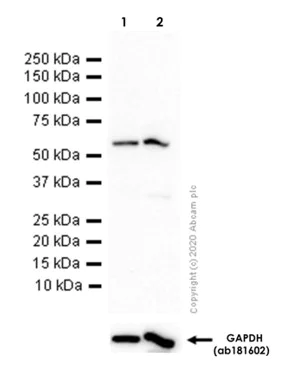 Western blot - Anti-Cytochrome P450 17A1/CYP17A1 antibody [EPR6294(2)] - BSA and Azide free (AB248723)