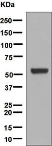 Western blot - Anti-Cytochrome P450 17A1/CYP17A1 antibody [EPR6294(2)] - BSA and Azide free (AB248723)