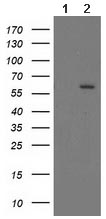 Western blot - Anti-Cytochrome P450 17A1/CYP17A1 antibody [OTI5G10] (AB118988)