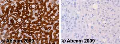 Immunohistochemistry (Formalin/PFA-fixed paraffin-embedded sections) - Anti-Cytochrome P450 1A2 antibody [d15 (16VII F10F12)] (AB22717), expandable thumbnail