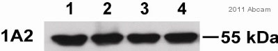 Western blot - Anti-Cytochrome P450 1A2 antibody [d15 (16VII F10F12)] (AB22717), expandable thumbnail