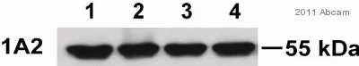 Western blot - Anti-Cytochrome P450 1A2 antibody [d15 (16VII F10F12)] (AB22717)