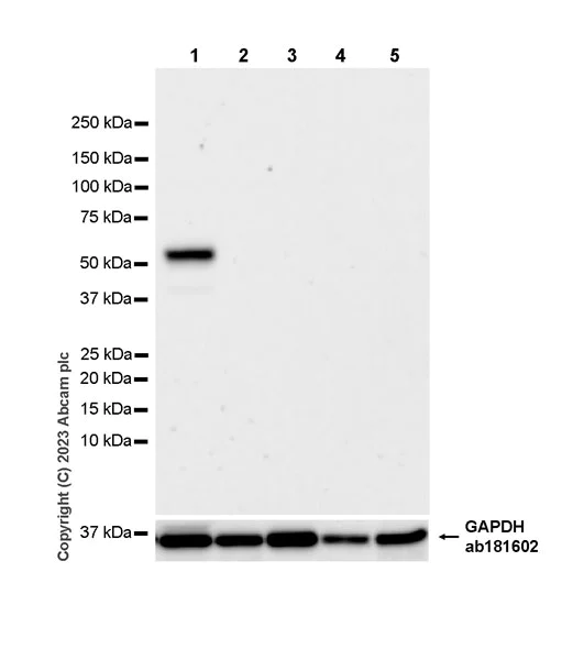 Western blot - Anti-Cytochrome P450 1A2 antibody [EPR28416-31] (AB314666)