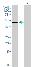 Western blot - Cytochrome P450 2A6 overexpression 293T lysate (whole cell) (AB94284)