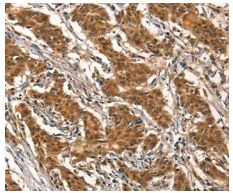 Immunohistochemistry (Formalin/PFA-fixed paraffin-embedded sections) - Anti-Cytochrome P450 2B6/CYP2B6 antibody (AB198870)