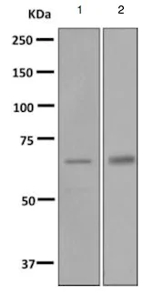 Western blot - Anti-Cytochrome P450 2B6/CYP2B6 antibody [EPR9985(B)] - BSA and Azide free (AB248900)
