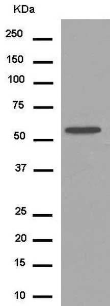 Western blot - Anti-Cytochrome p450 2C19 antibody [EPR6577] - BSA and Azide free (AB250812)