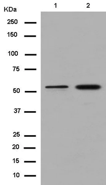 Western blot - Anti-Cytochrome p450 2C19 antibody [EPR6577] - C-terminal (AB185213)