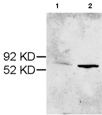 Western blot - Anti-Cytochrome P450 2E1 antibody (AB53945)